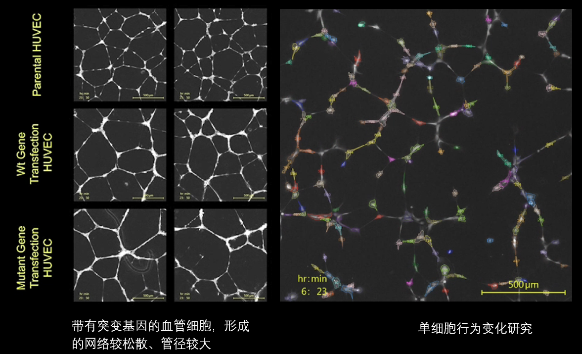 6、血管分析.png